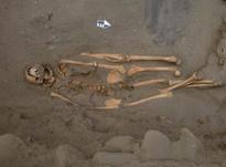 В Перу найдены скелеты людей с четырьмя ногами и руками