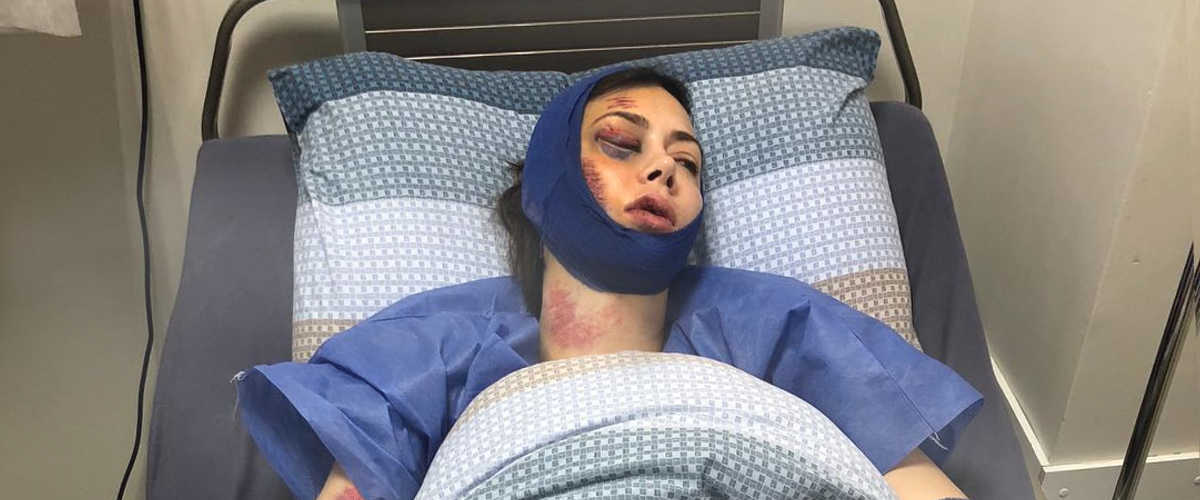Настасья Самбурская заявила об избиении и выложила фото из больницы